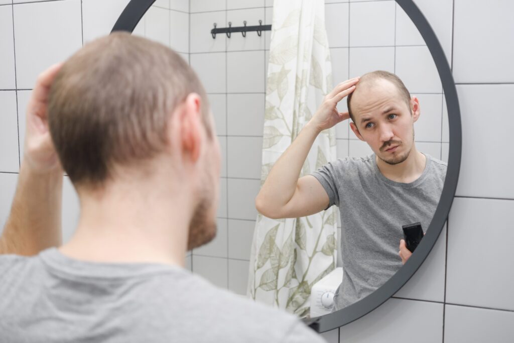 Erkeklerde Saç Dökülmesi Neden Olur?