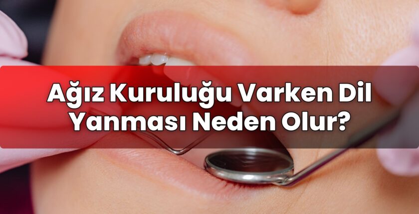 Ağız Kuruluğu Varken Dil Yanması Neden Olur?