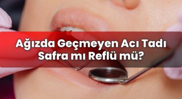 Ağızda Geçmeyen Acı Tadı Safra mı Reflü mü?