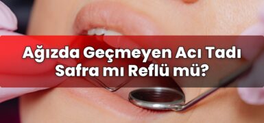 Ağızda Geçmeyen Acı Tadı Safra mı Reflü mü?