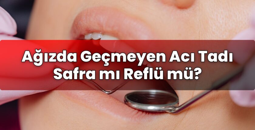 Ağızda Geçmeyen Acı Tadı Safra mı Reflü mü?