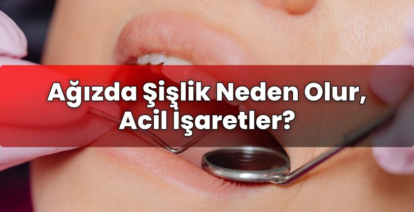 Ağızda Şişlik Neden Olur, Acil İşaretler?