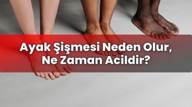 Ayak Şişmesi Neden Olur, Ne Zaman Acildir?