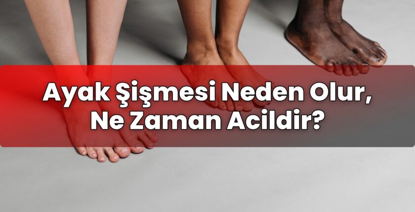 Ayak Şişmesi Neden Olur, Ne Zaman Acildir?