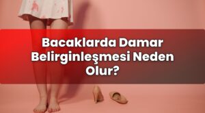 Bacaklarda Damar Belirginleşmesi Neden Olur?