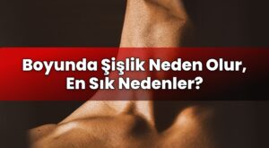 Boyunda Şişlik Neden Olur, En Sık Nedenler?