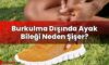 Burkulma Dışında Ayak Bileği Neden Şişer?
