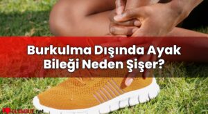 Burkulma Dışında Ayak Bileği Neden Şişer?