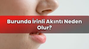 Burunda İrinli Akıntı Neden Olur?