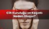 Cilt Kuruluğu ve Kaşıntı Neden Oluşur?