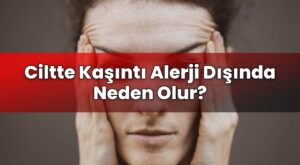 Ciltte Kaşıntı Alerji Dışında Neden Olur?
