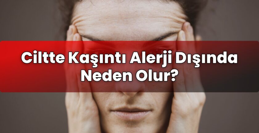 Ciltte Kaşıntı Alerji Dışında Neden Olur?