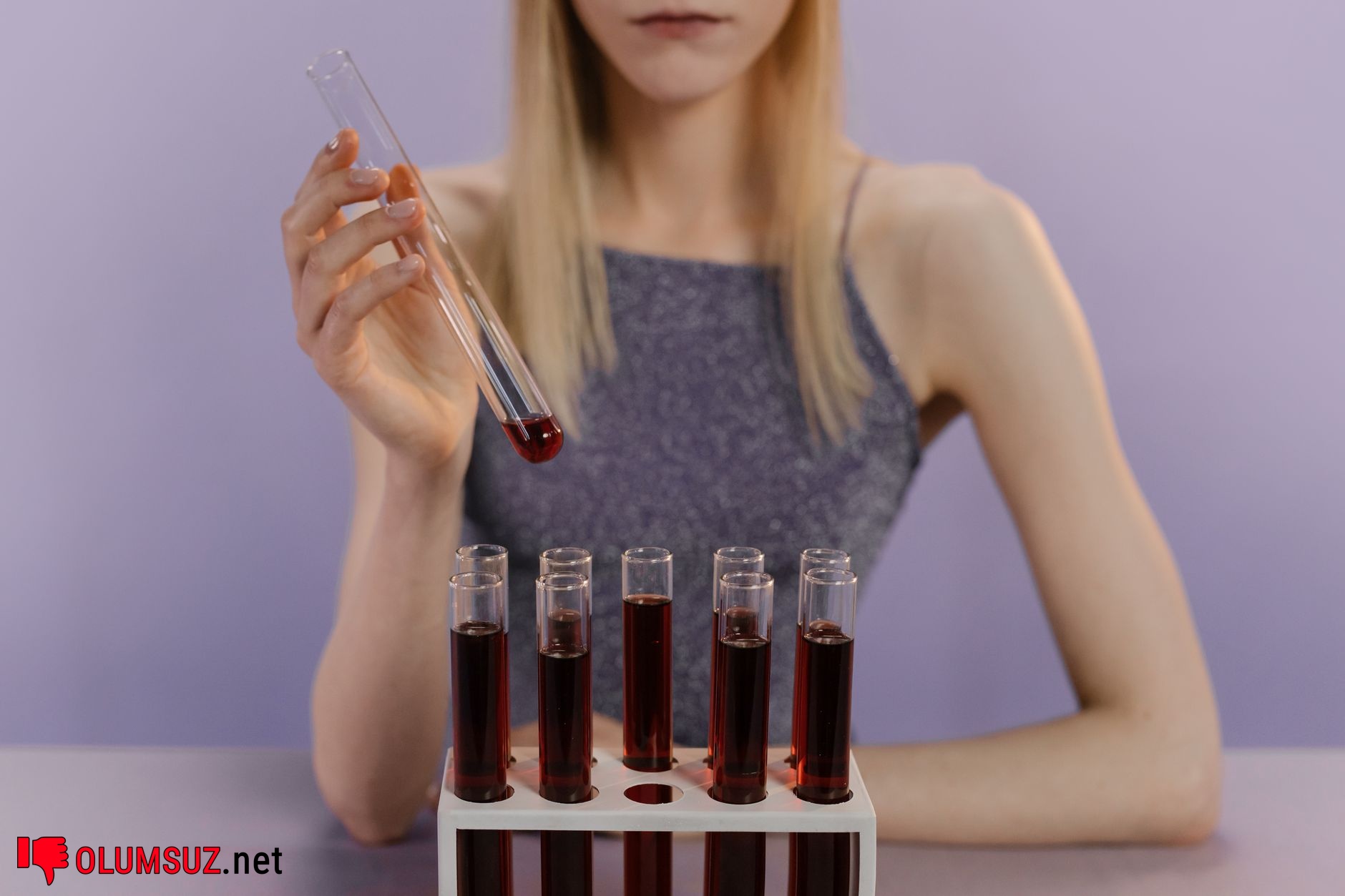 Kansızlıkla ilişki: hemoglobin düşüklüğü görseli ve kan testi