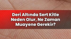Deri Altında Sert Kitle Neden Olur, Ne Zaman Muayene Gerekir?