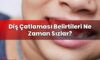 Diş Çatlaması Belirtileri Ne Zaman Sızlar?