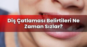 Diş Çatlaması Belirtileri Ne Zaman Sızlar?
