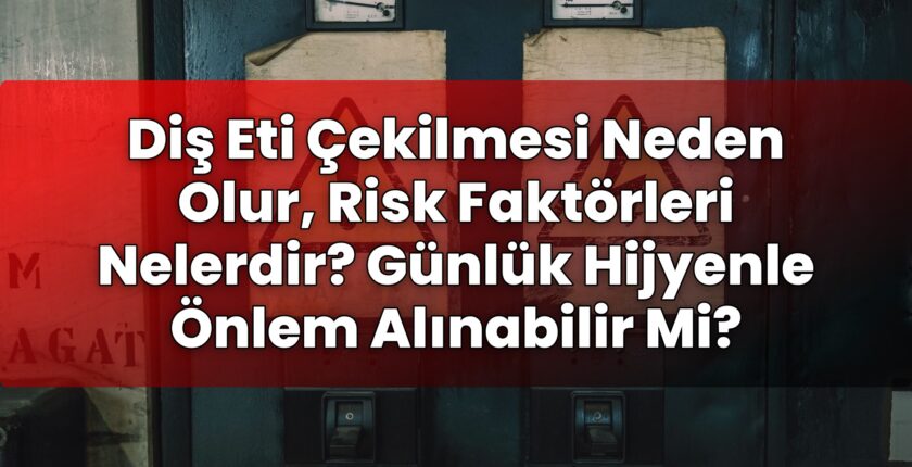 Diş Eti Çekilmesi Neden Olur, Risk Faktörleri Nelerdir? Günlük Hijyenle Önlem
Alınabilir Mi?