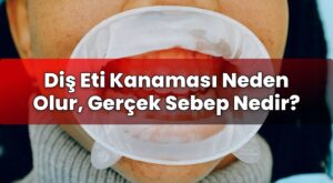 Diş Eti Kanaması Neden Olur, Gerçek Sebep Nedir?