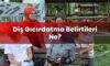 Diş Gıcırdatma Belirtileri Ne?