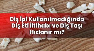 Diş İpi Kullanılmadığında Diş Eti İltihabı ve Diş Taşı Hızlanır mı?
