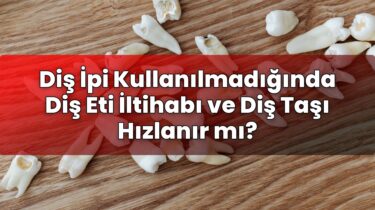 Diş İpi Kullanılmadığında Diş Eti İltihabı ve Diş Taşı Hızlanır mı?