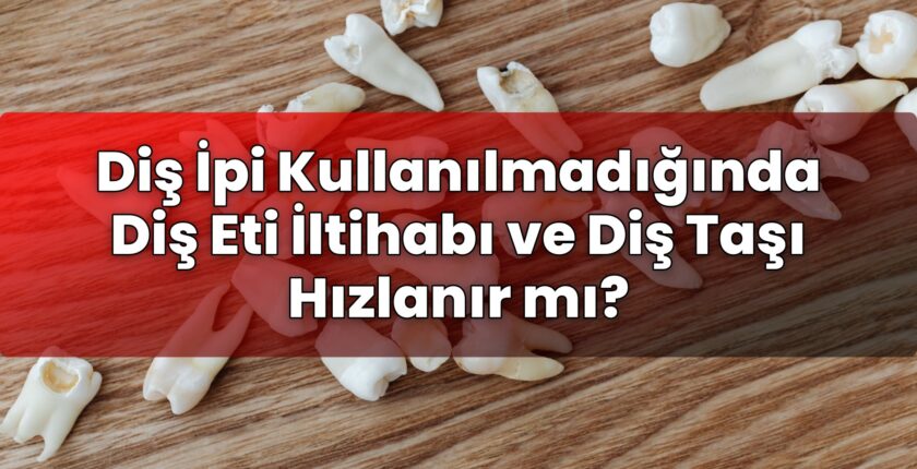 Diş İpi Kullanılmadığında Diş Eti İltihabı ve Diş Taşı Hızlanır mı?