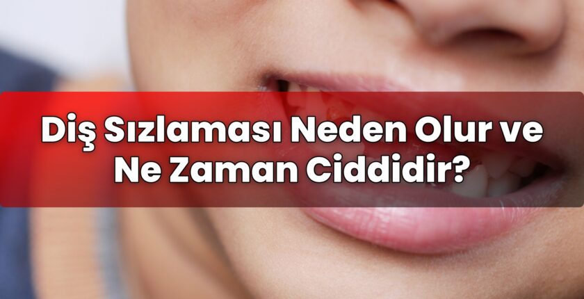 Diş Sızlaması Neden Olur ve Ne Zaman Ciddidir?