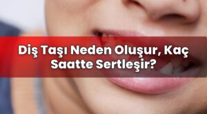 Diş Taşı Neden Oluşur, Kaç Saatte Sertleşir?