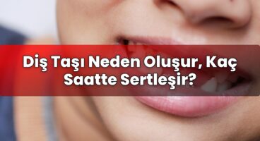 Diş Taşı Neden Oluşur, Kaç Saatte Sertleşir?