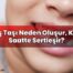 Diş Taşı Neden Oluşur, Kaç Saatte Sertleşir?