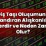 Diş Taşı Oluşumunu Hızlandıran Alışkanlıklar Nelerdir ve Neden Zararlı Olur?