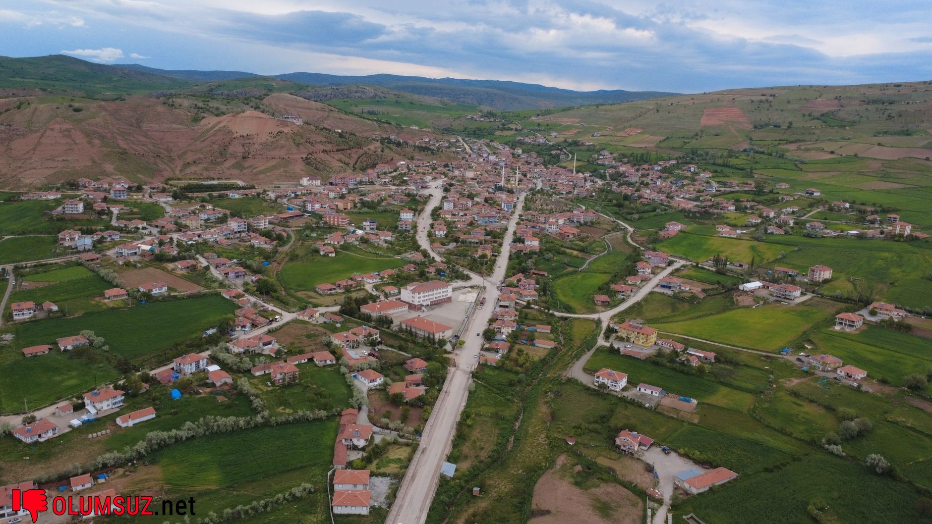 Diş hekimi skalpelle diş taşı temizliği yapıyor