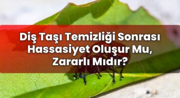 Diş Taşı Temizliği Sonrası Hassasiyet Oluşur Mu, Zararlı Mıdır?
