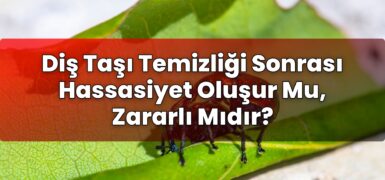 Diş Taşı Temizliği Sonrası Hassasiyet Oluşur Mu, Zararlı Mıdır?