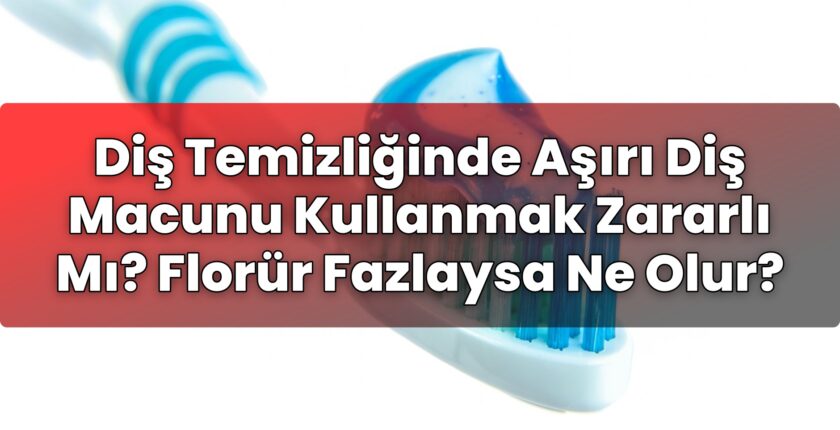 Diş Temizliğinde Aşırı Diş Macunu Kullanmak Zararlı Mı? Florür Fazlaysa Ne Olur?