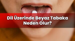 Dil Üzerinde Beyaz Tabaka Neden Olur?