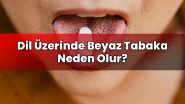 Dil Üzerinde Beyaz Tabaka Neden Olur?