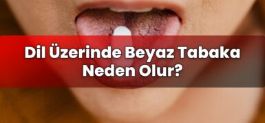 Dil Üzerinde Beyaz Tabaka Neden Olur?