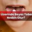 Dil Üzerinde Beyaz Tabaka Neden Olur?