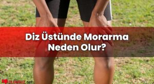 Diz Üstünde Morarma Neden Olur?