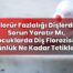 Florür Fazlalığı Dişlerde Sorun Yaratır Mı, Çocuklarda Diş Florozisini Günlük Ne
Kadar Tetikler?