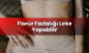 Florür Fazlalığı Leke Yapabilir