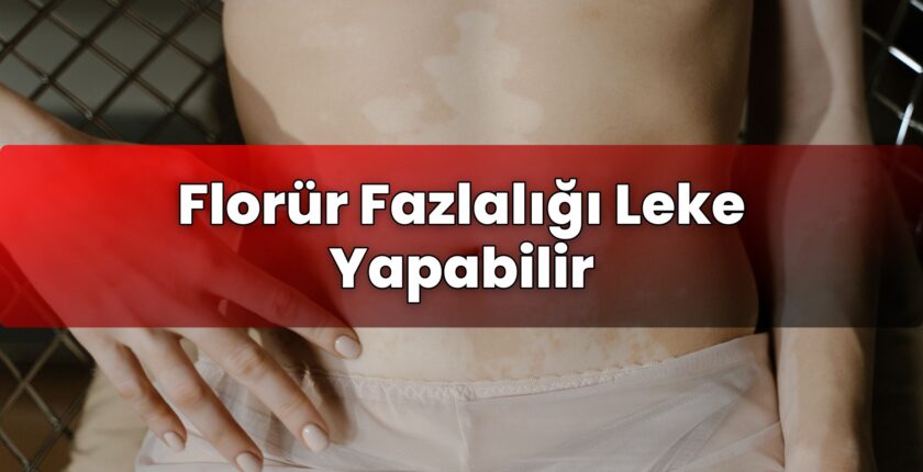 Florür Fazlalığı Leke Yapabilir