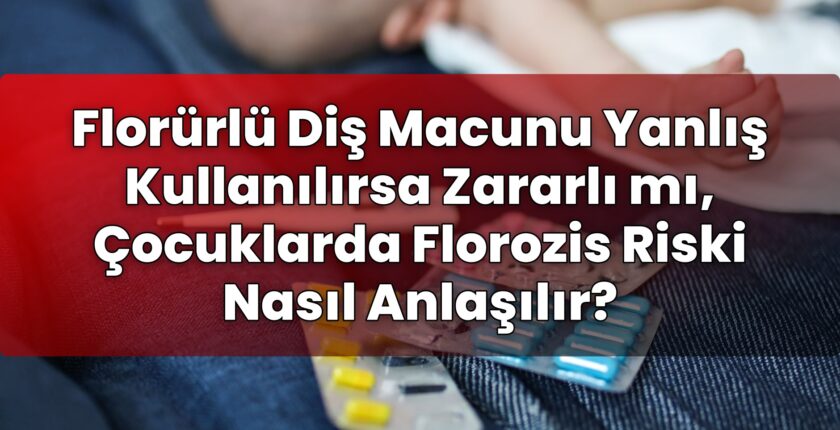 Florürlü Diş Macunu Yanlış Kullanılırsa Zararlı mı, Çocuklarda Florozis Riski
Nasıl Anlaşılır?