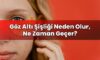 Göz Altı Şişliği Neden Olur, Ne Zaman Geçer?