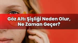 Göz Altı Şişliği Neden Olur, Ne Zaman Geçer?