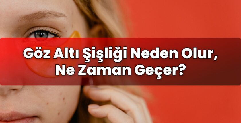 Göz Altı Şişliği Neden Olur, Ne Zaman Geçer?