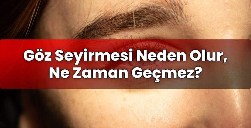 Göz Seyirmesi Neden Olur, Ne Zaman Geçmez?