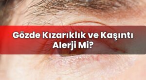 Gözde Kızarıklık ve Kaşıntı Alerji Mi?