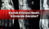 Kemik Erimesi Nedir, Kimlerde Görülür?